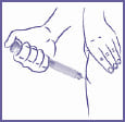 APOGOPEN