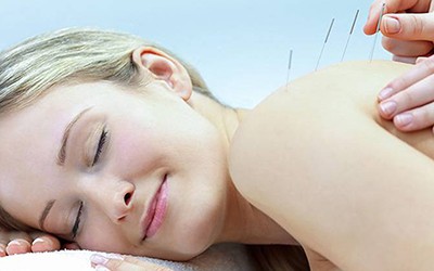 Acupunctura pode ser eficaz no alívio da dor