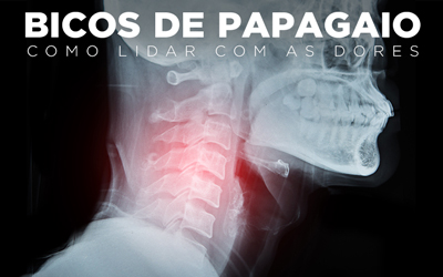 BICOS DE PAPAGAIO, COMO LIDAR COM AS DORES BICOS DE PAPAGAIO, COMO LIDAR COM AS DORES