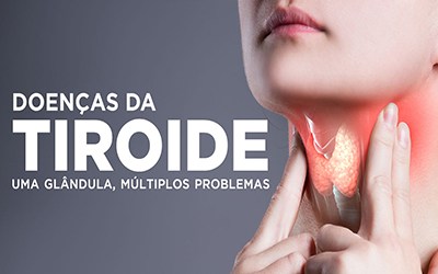 DOENÇAS DA TIROIDE - Uma glândula, múltiplos problemas!