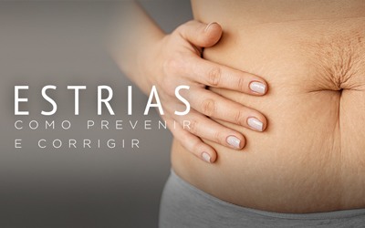 ESTRIAS, COMO PREVENIR E CORRIGIR ESTRIAS, COMO PREVENIR E CORRIGIR