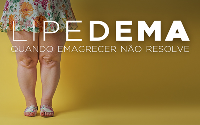 LIPEDEMA, QUANDO EMAGRECER NÃO RESOLVE LIPEDEMA, QUANDO EMAGRECER NÃO RESOLVE