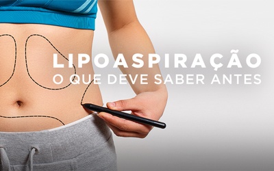 LIPOASPIRAÇÃO, O QUE DEVE SABER ANTES LIPOASPIRAÇÃO, O QUE DEVE SABER ANTES