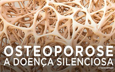 OSTEOPOROSE, A DOENÇA SILENCIOSA