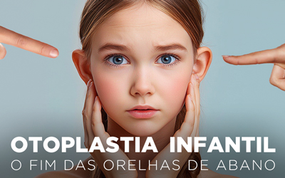 OTOPLASTIA INFANTIL, O FIM DAS ORELHAS DE ABANO OTOPLASTIA INFANTIL, O FIM DAS ORELHAS DE ABANO