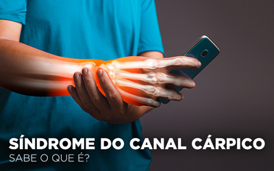 SÍNDROME DO CANAL CÁRPICO: SABE O QUE É? SÍNDROME DO CANAL CÁRPICO: SABE O QUE É?