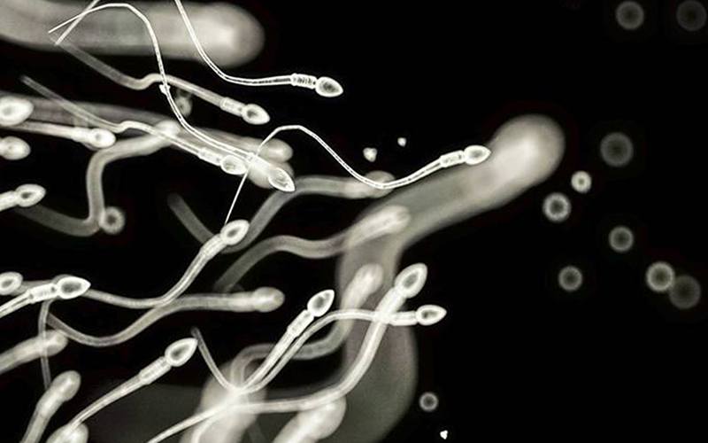 Baixa contagem de espermatozoides associada a vários problemas de saúde