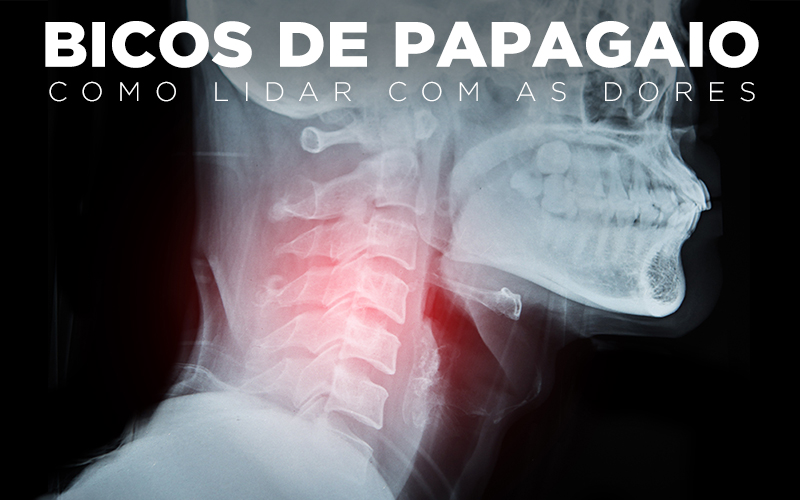 BICOS DE PAPAGAIO, COMO LIDAR COM AS DORES BICOS DE PAPAGAIO, COMO LIDAR COM AS DORES