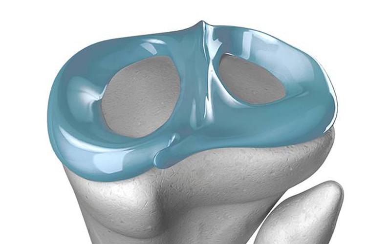 Cientistas criam cartilagem artificial similar à natural