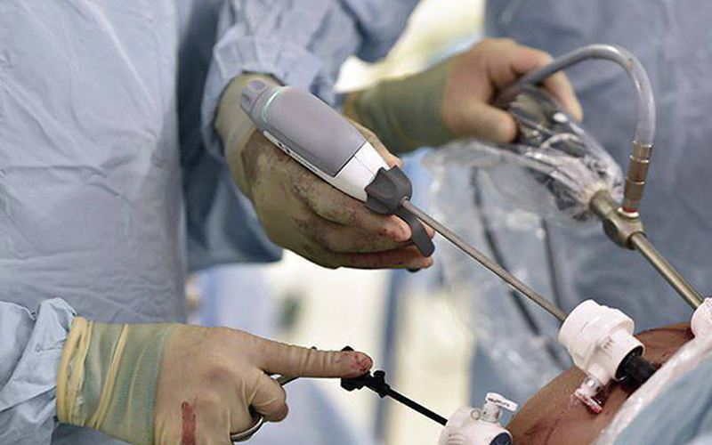 Cirurgia contra obesidade previne doença renal crónica grave