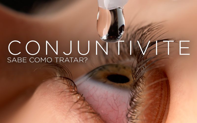 CONJUNTIVITE, SABE COMO TRATAR? CONJUNTIVITE, SABE COMO TRATAR?