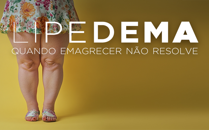 LIPEDEMA, QUANDO EMAGRECER NÃO RESOLVE LIPEDEMA, QUANDO EMAGRECER NÃO RESOLVE
