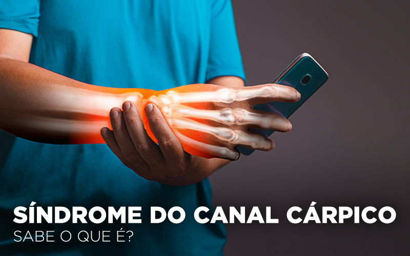 SÍNDROME DO CANAL CÁRPICO: SABE O QUE É? SÍNDROME DO CANAL CÁRPICO: SABE O QUE É?
