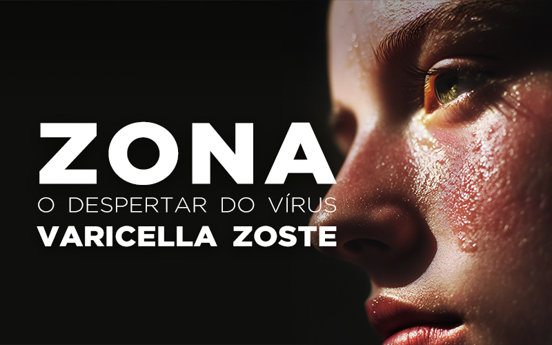 ZONA, O DESPERTAR DO VÍRUS VARICELLA ZOSTER