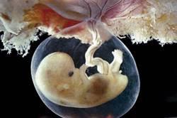 embrião