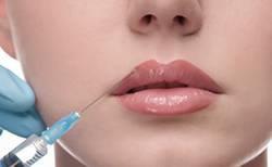 lábios bioplastia