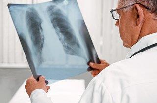 médico radiografia