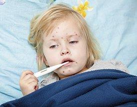 Criança com sarampo