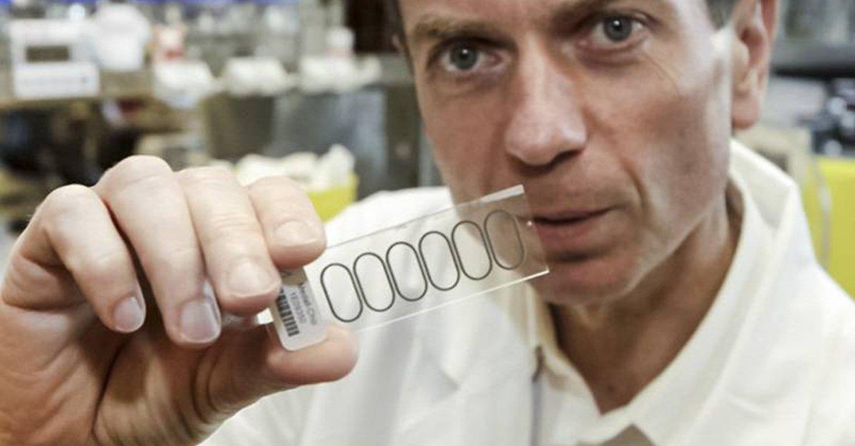 Chip inovador deteta 100 alérgenos usando sangue seco