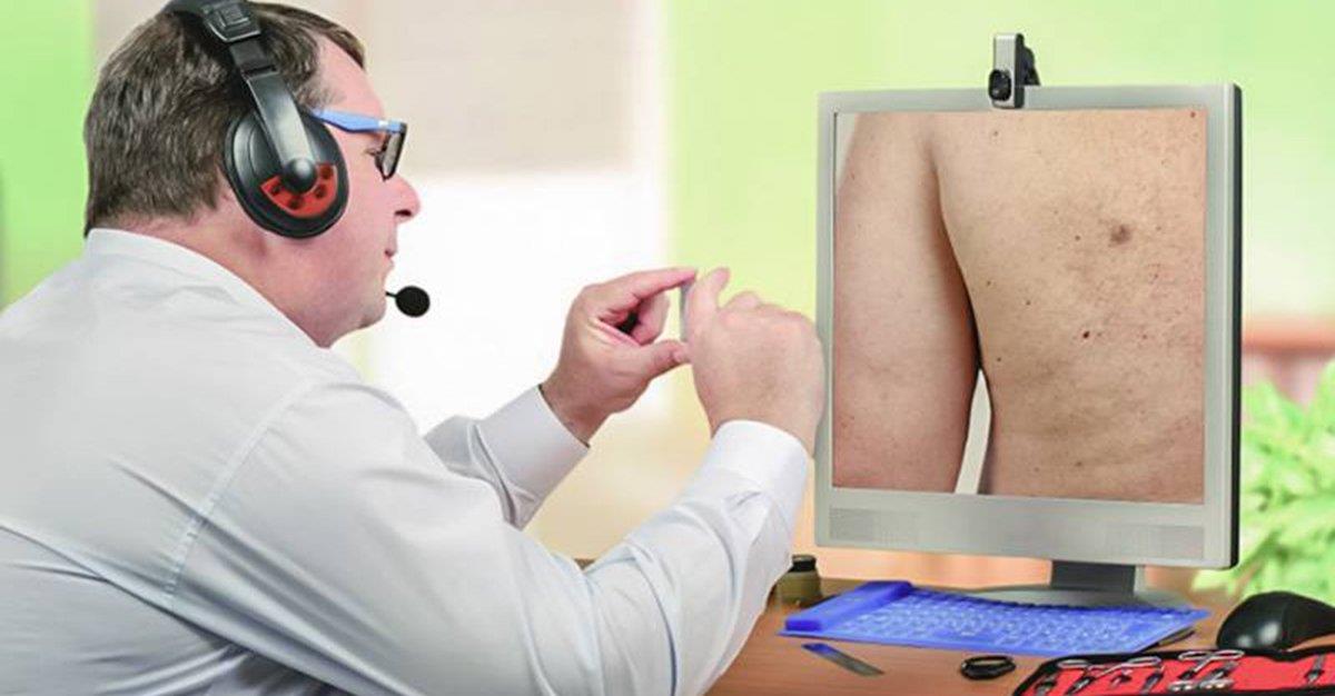 Especialistas preocupados com consultas de dermatologia por telemedicina