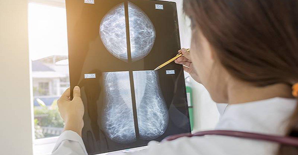 Novo tratamento para cancro da mama autorizado em meio hospitalar