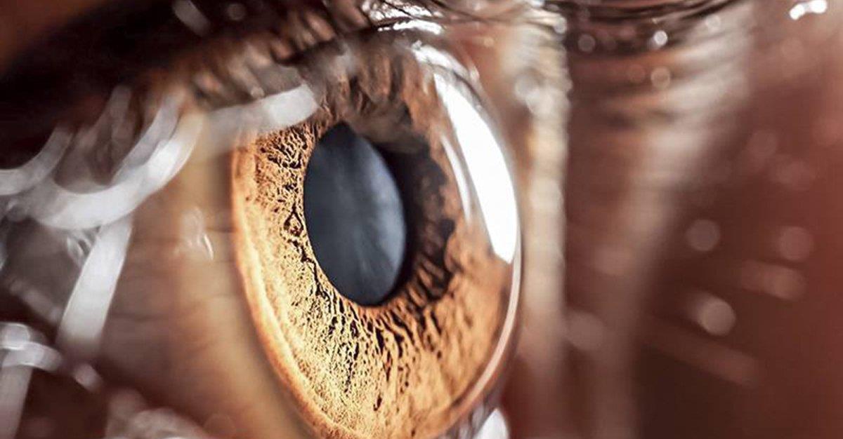 Portugal debate novos caminhos para tratar doença rara que pode provocar cegueira