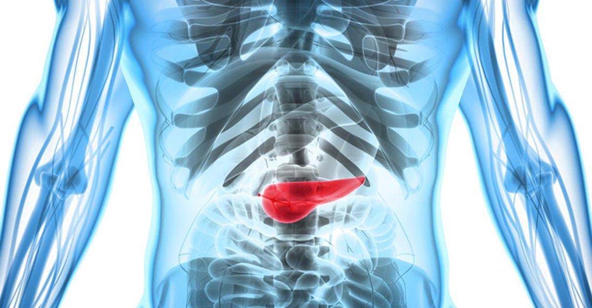 Protocolo FOLFIRINOX melhora resultados em cancro do pâncreas