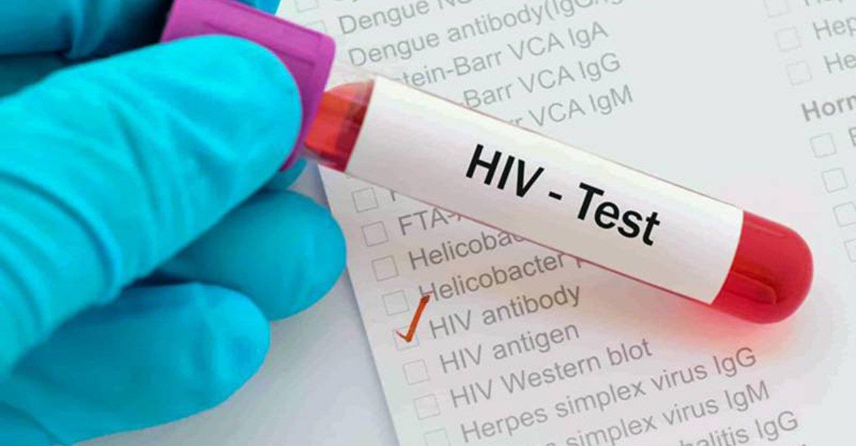 Técnica inovadora permite identificar potenciais infetados por VIH