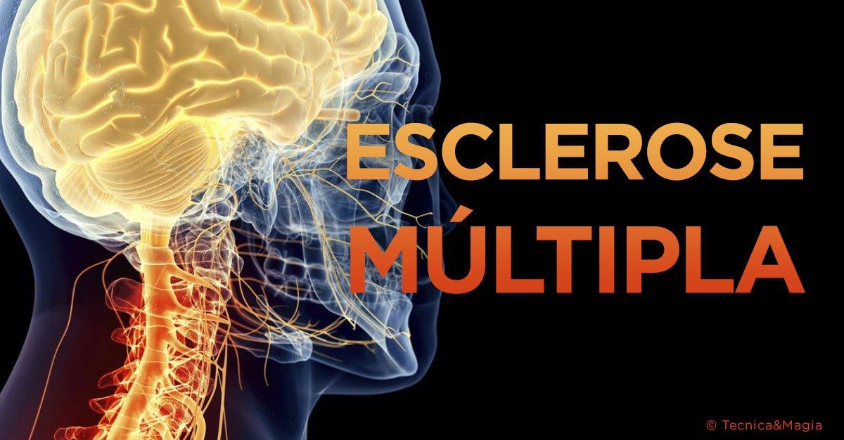 Image result for esclerose multipla