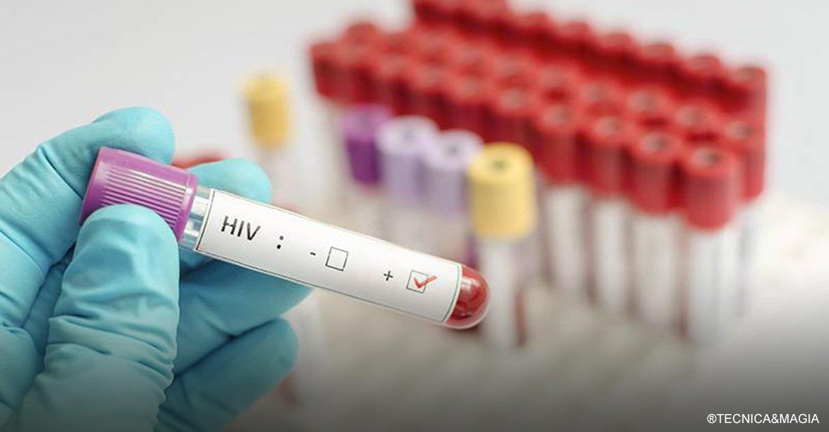 Epidemia de VIH/sida na Europa cresce a ritmo alarmante