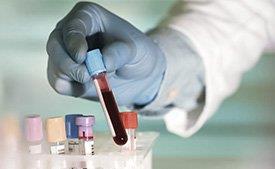 Cientista com amostra de sangue