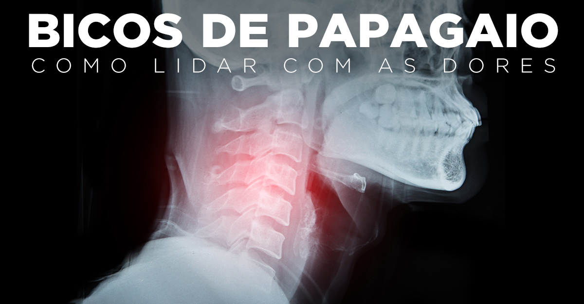 BICOS DE PAPAGAIO, COMO LIDAR COM AS DORES BICOS DE PAPAGAIO, COMO LIDAR COM AS DORES