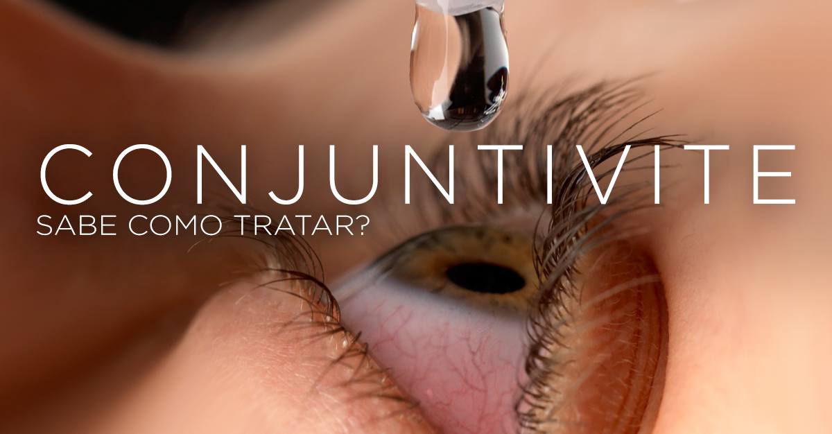 Artigos - CONJUNTIVITE, SABE COMO TRATAR?