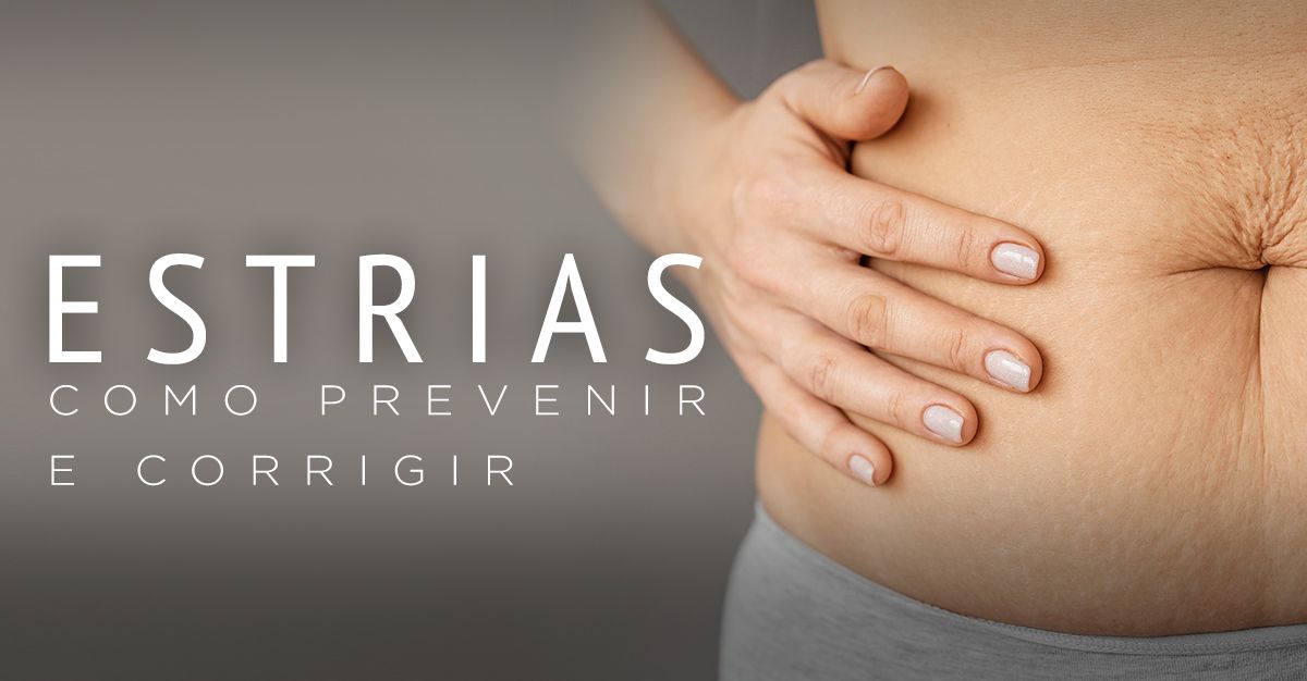 ESTRIAS, COMO PREVENIR E CORRIGIR ESTRIAS, COMO PREVENIR E CORRIGIR