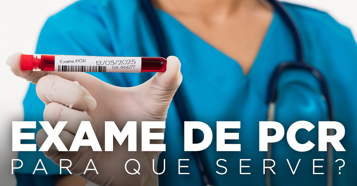 EXAME DE PCR, PARA QUE SERVE? EXAME DE PCR, PARA QUE SERVE?