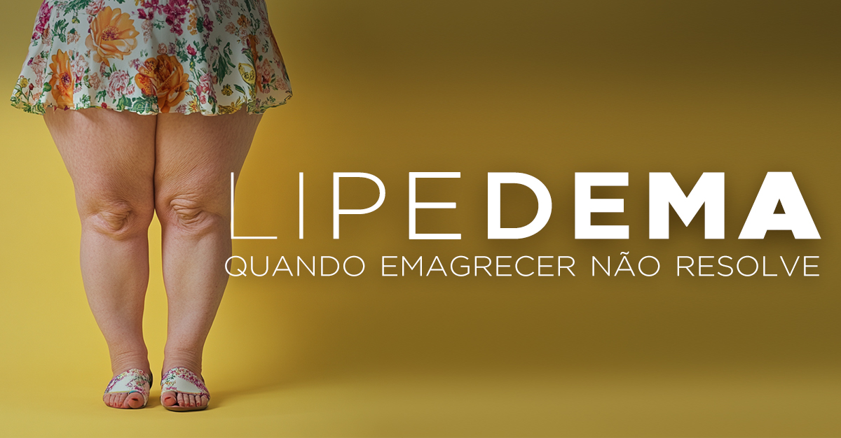 LIPEDEMA, QUANDO EMAGRECER NÃO RESOLVE LIPEDEMA, QUANDO EMAGRECER NÃO RESOLVE