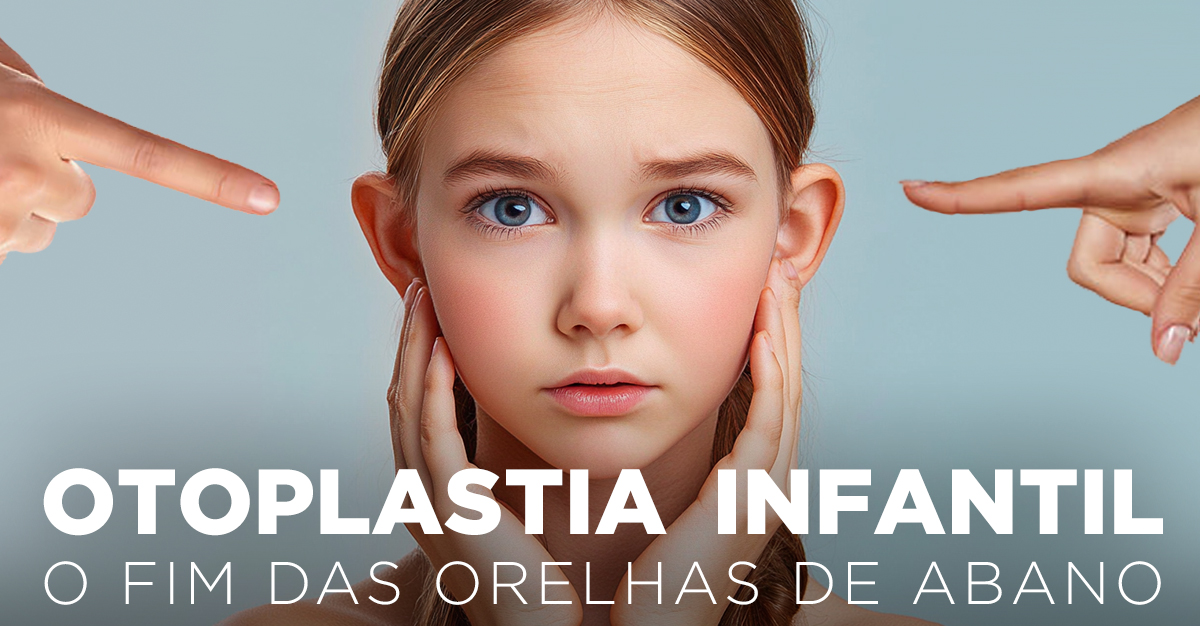 OTOPLASTIA INFANTIL, O FIM DAS ORELHAS DE ABANO OTOPLASTIA INFANTIL, O FIM DAS ORELHAS DE ABANO