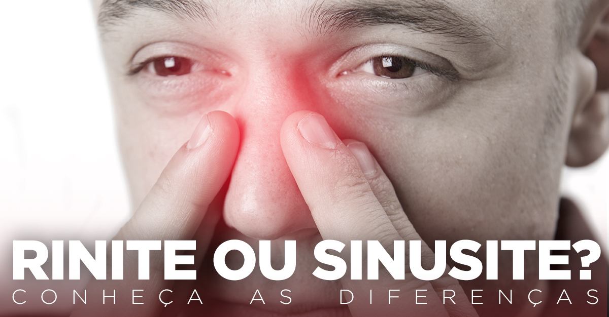 Artigos - RINITE OU SINUSITE? CONHEÇA AS DIFERENÇAS
