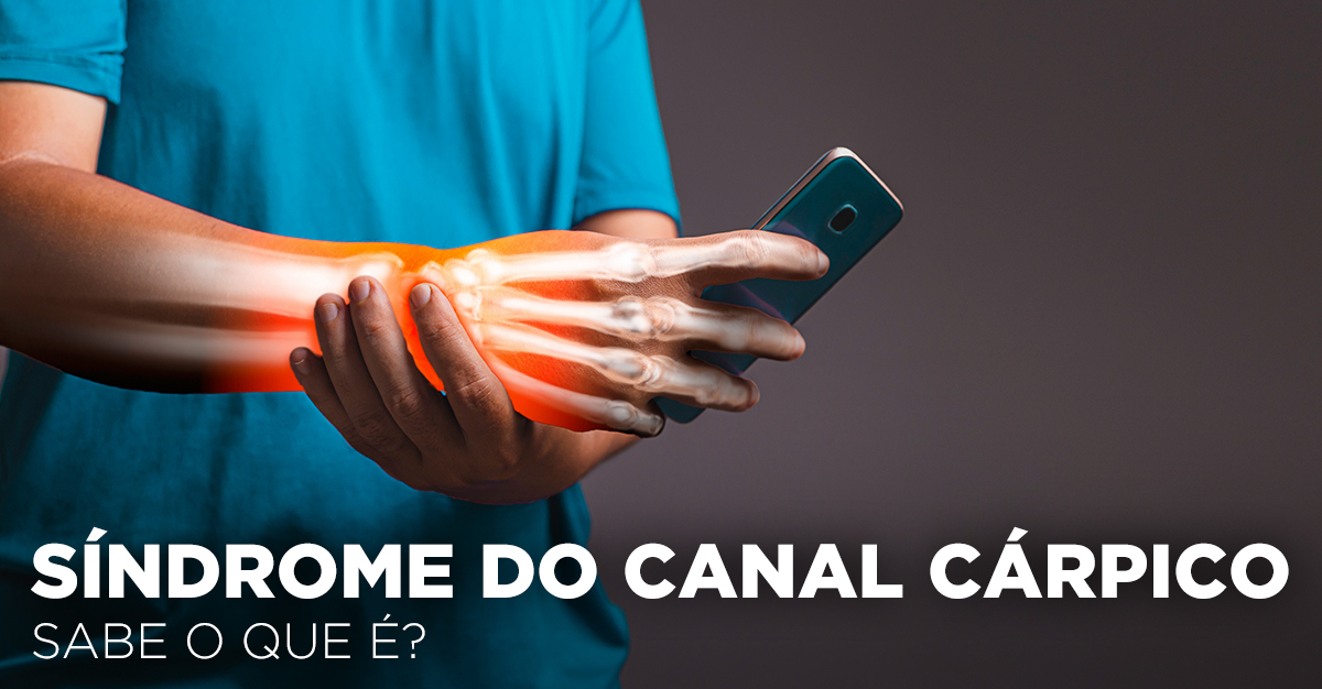 SÍNDROME DO CANAL CÁRPICO: SABE O QUE É? SÍNDROME DO CANAL CÁRPICO: SABE O QUE É?