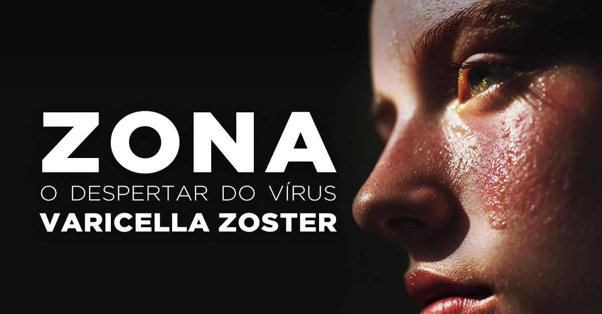 ZONA, O DESPERTAR DO VÍRUS VARICELLA ZOSTER ZONA, O DESPERTAR DO VÍRUS VARICELLA ZOSTER
