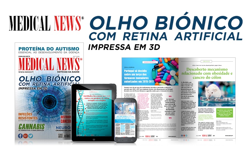 Retina Artificial impressa em 3D Retina Artificial impressa em 3D