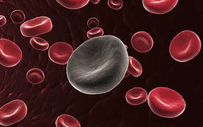 Células de leucemia perigosas podem ser forçadas a amadurecer
