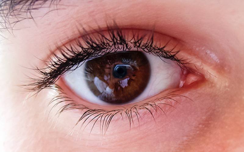 Fármaco para tratar epilepsia pode proteger visão de pacientes com esclerose múltipla