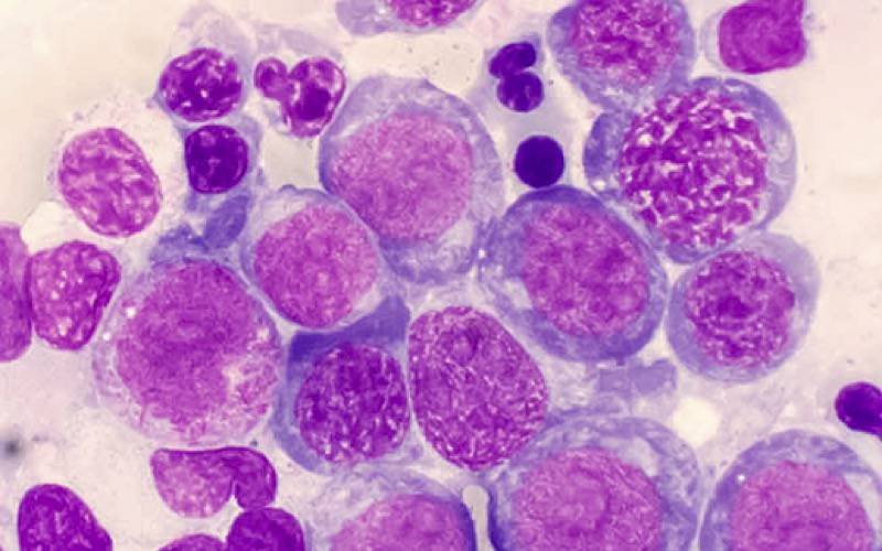 Estudo revela como lenalidomida combate cancro e trata síndrome que afeta o sangue