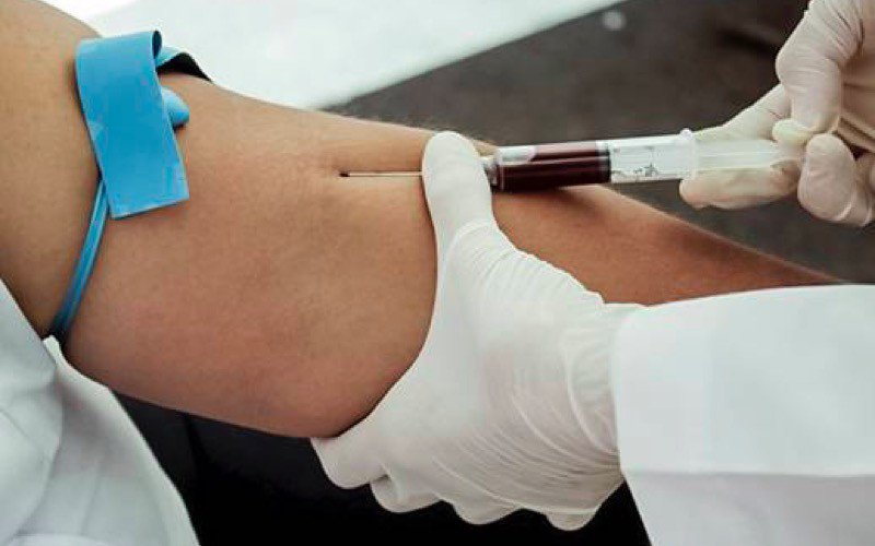 Exame de sangue deteta reincidência do cancro
