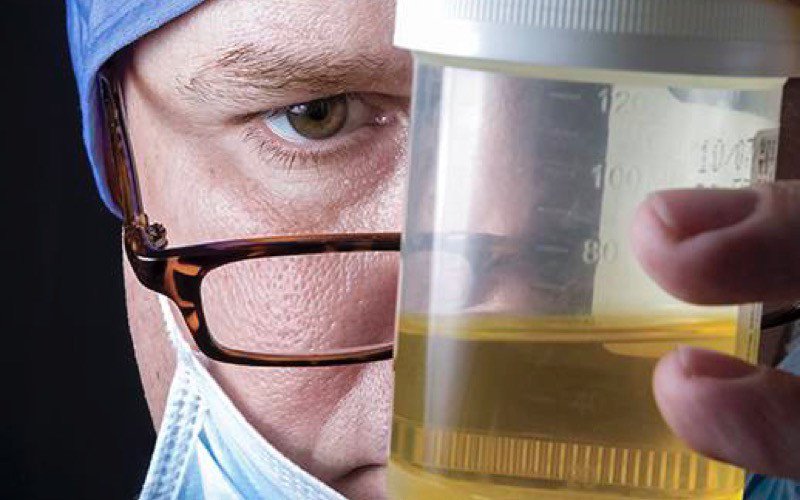 Teste de urina pode ser nova esperança para cancro do pâncreas