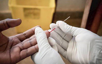 Angola em Risco de Epidemia grave de VIH/SIDA