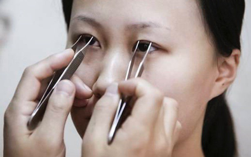 China pode tornar-se Terceiro Mercado Mundial de Cirurgia Estética