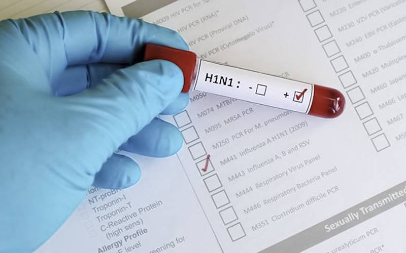 Registadas 230 mortes pelo vírus H1N1 no Brasil este ano
