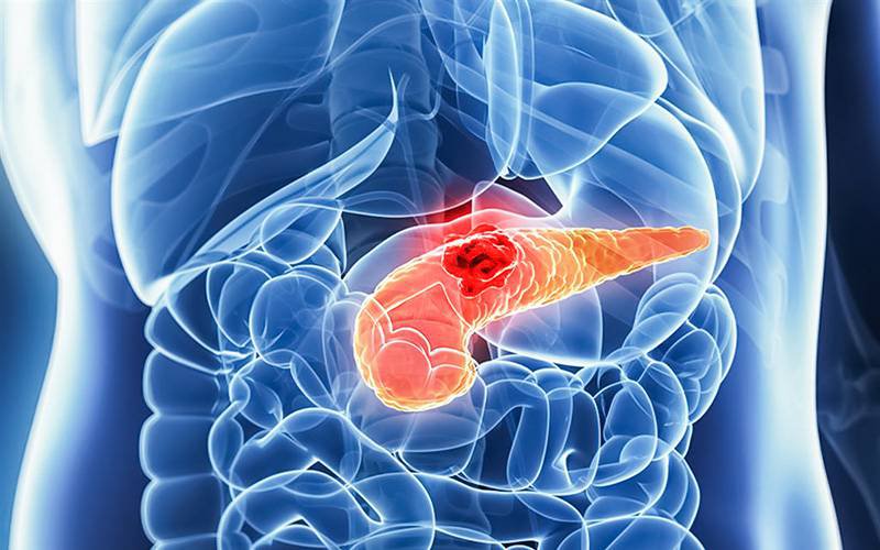 Nova imunoterapia pode levar a melhores resultados contra cancro do pâncreas